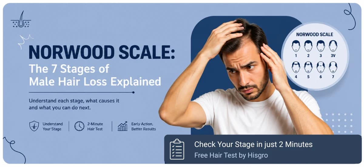 Norwood Scale: The 7 Stages of Balding Male Hair Loss Explained